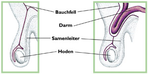 Platzhalter