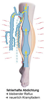Fehlerhafte Abdichtung